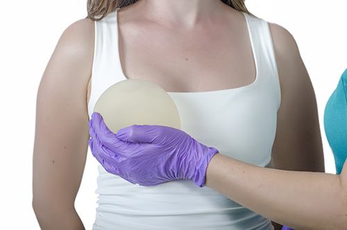 breast-augmentation-implants