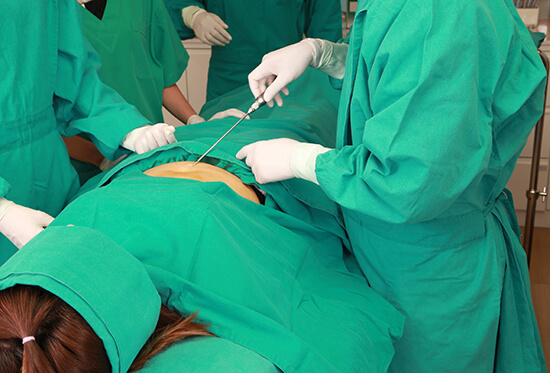 tummy tuck surgery