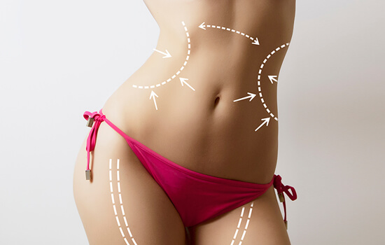 vaser liposuction surgery uk